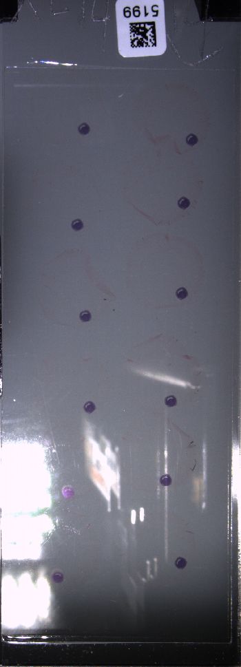Media type: image; Special Collections 4011   shows specimen_part histological serial section;